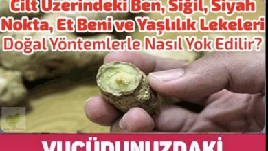 Photo of Et Benlerinden Kurtulun