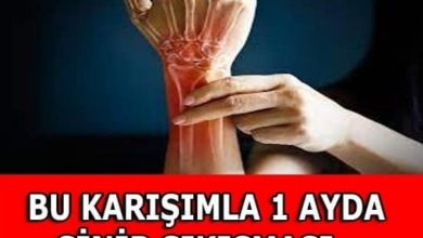 Photo of SİNİR SIKIŞMASI İLTİHAP VE ROMATİZMAYI BİTİRİN