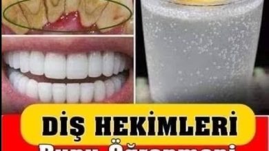 Photo of Dişçiye Gitmeden Tartar Temizlemek