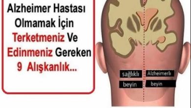 Photo of Alzheimer Hastası Olmamak için dikkat
