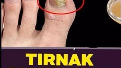 Photo of Tırnak mantarından kurtulmak bu kadar basitmiş