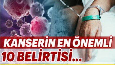 Photo of Kanserin En Önemli 10 Belirtisi